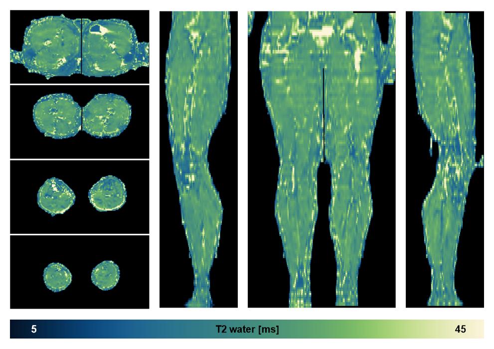 The water only T2 relaxation time of the lower extremity obtained from multi echo spin echo t2 mapping with EPG based reconstruction.